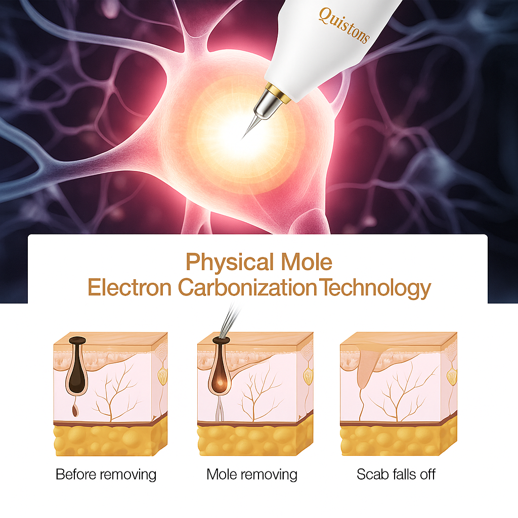 Quistons Beauty Pen — See Visible Results Fast Effectively Removes Moles, Skin Tags, Cherry Angiomas & Warts